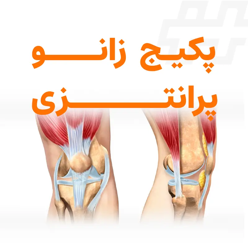 پکیج زانو پرانتزی