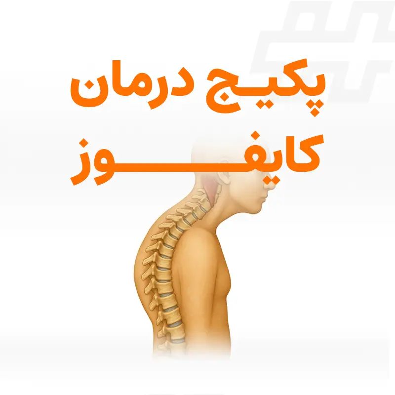 پکیج درمان کایفوز