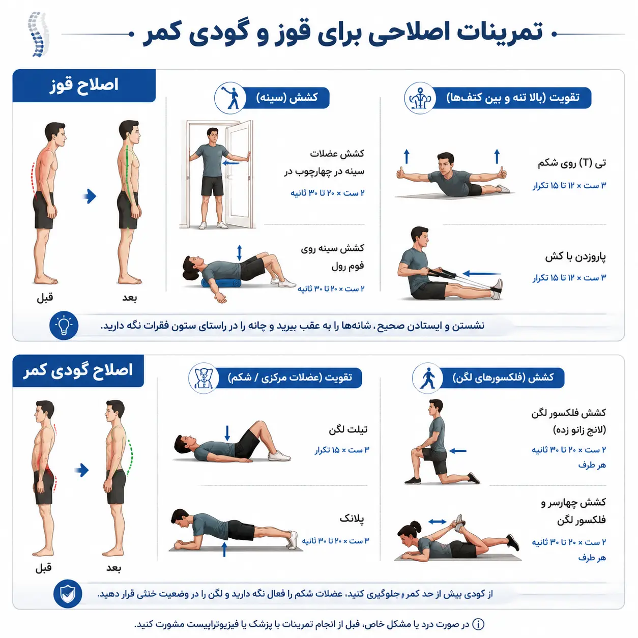 معرفی تمرینات کلیدی برای اصلاح قوز کمر و گودی کمر